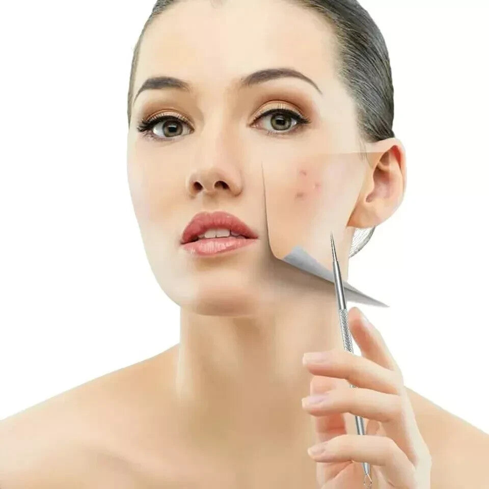 TC Blackhead Pimple Remover Comedone Spot Acne Extractor Kit Popper Tools