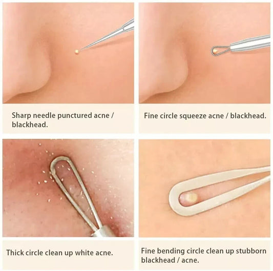 TC Blackhead Pimple Remover Comedone Spot Acne Extractor Kit Popper Tools